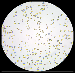 An iPhone mounted to a compound microscope displays an image of detected algal cells.